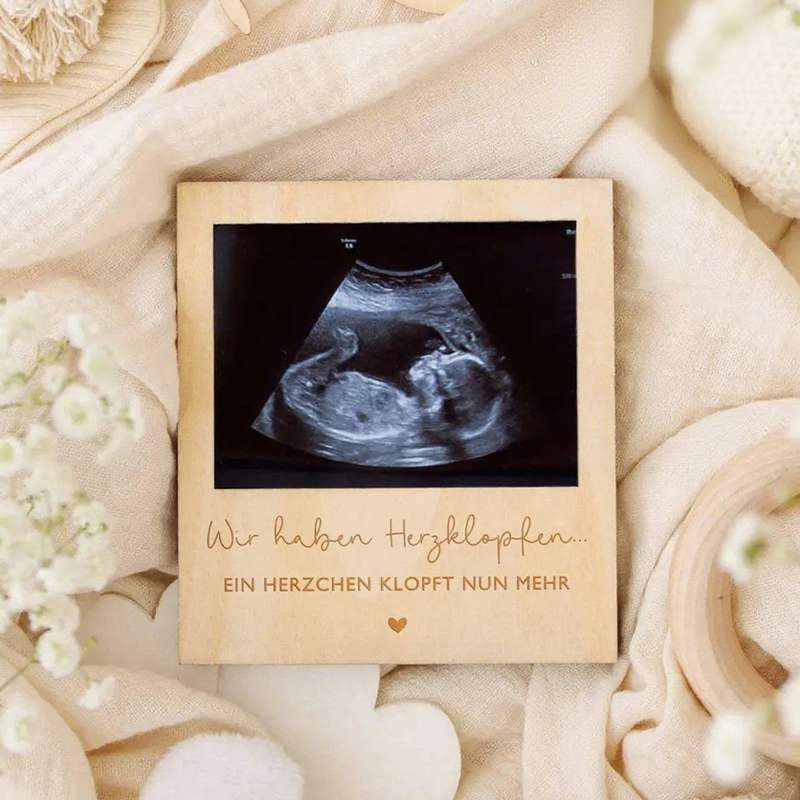 Ultrasound Pregnancy Announcem - Baby Nursery Images 评论和价格