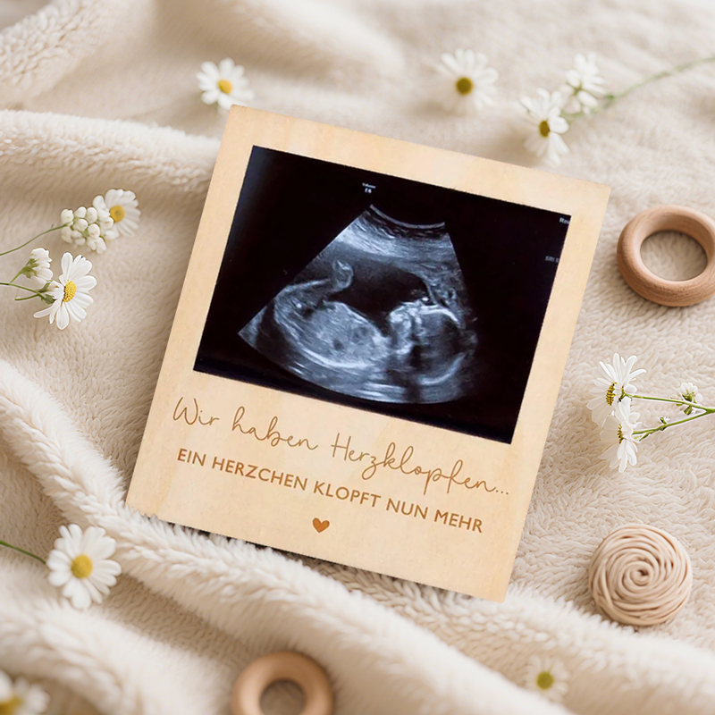 Ultrasound Pregnancy Announcem - Baby Nursery Images 评论和价格