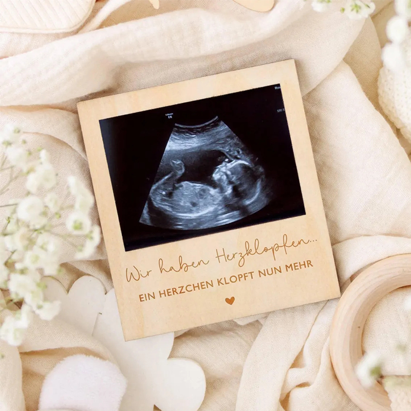 Ultrasound Pregnancy Announcem - Baby Nursery Images 评论和价格